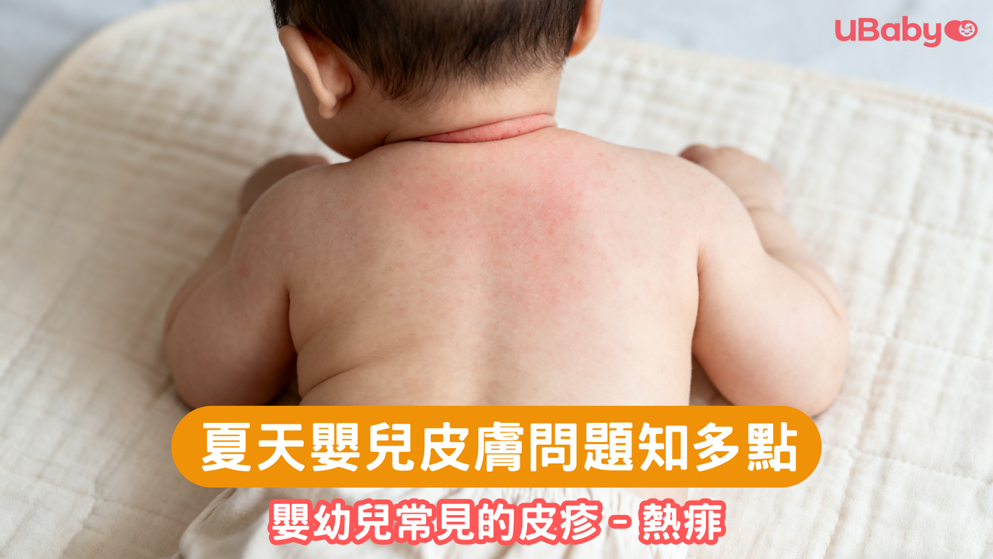 夏天嬰兒皮膚問題知多點
