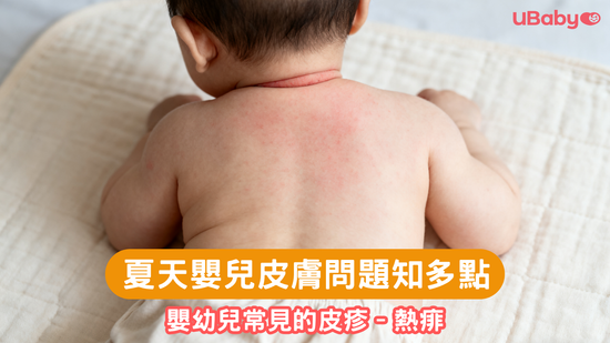 夏天嬰兒皮膚問題知多點