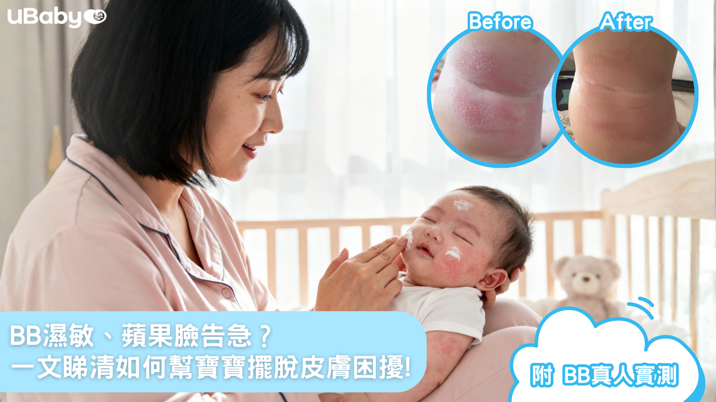 【真實媽媽團實測】BB濕敏、蘋果臉告急？一文睇清如何幫寶寶擺脫皮膚困擾！