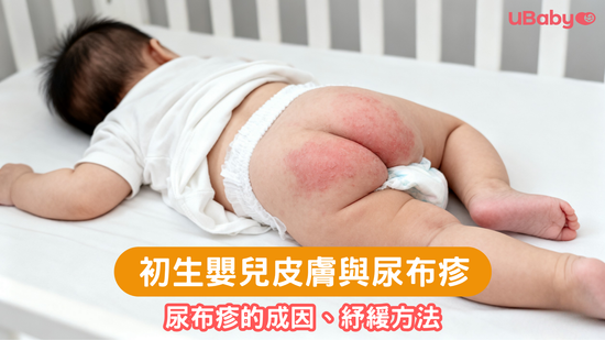 初生嬰兒皮膚與尿布疹