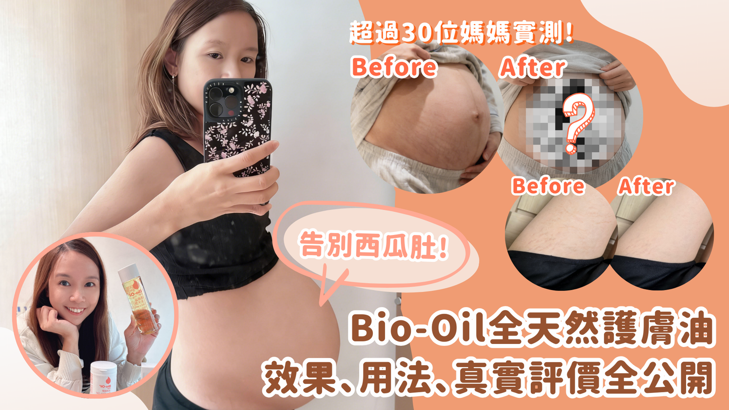 告別西瓜肚！ Bio-Oil全天然護膚油真實評價全公開