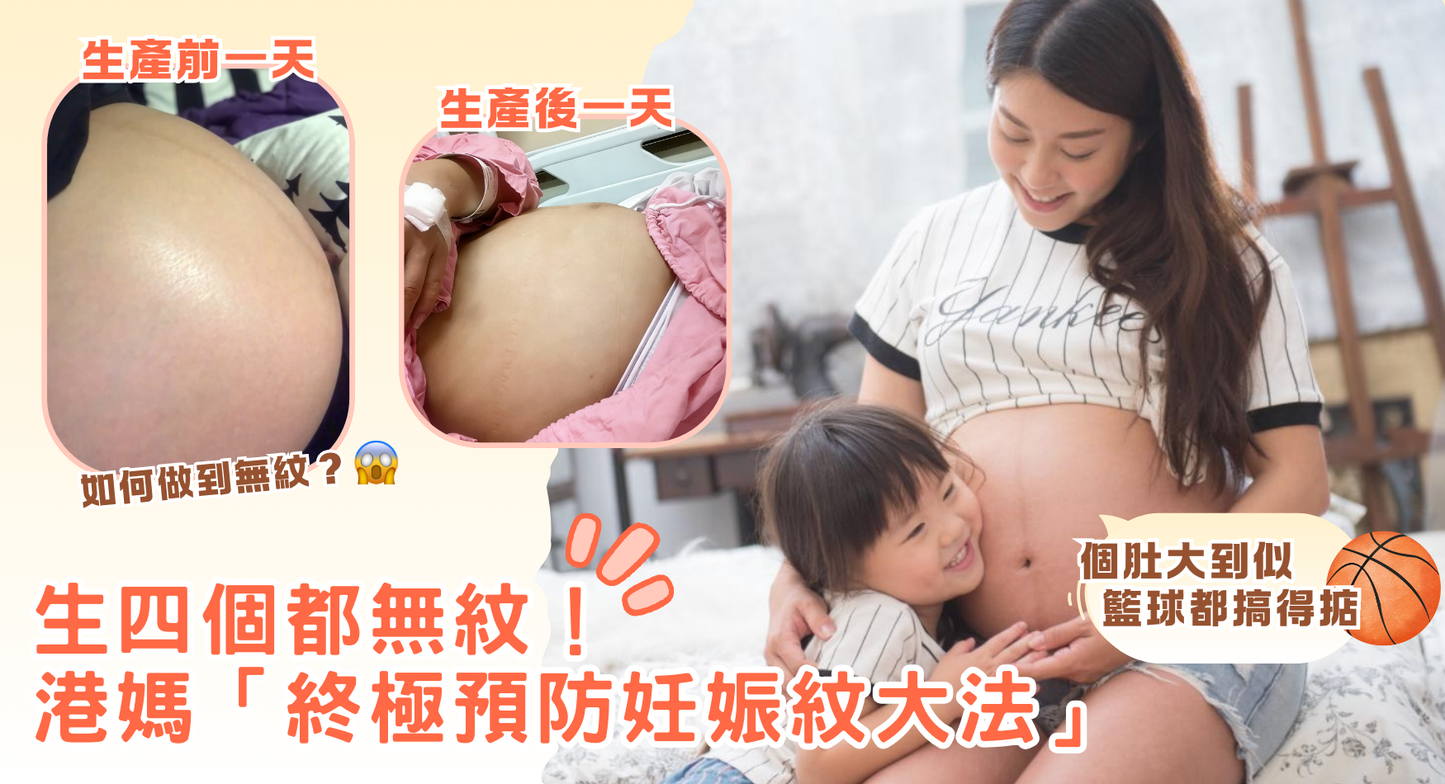 生四個都無紋！ 港媽「終極預防妊娠紋大法」