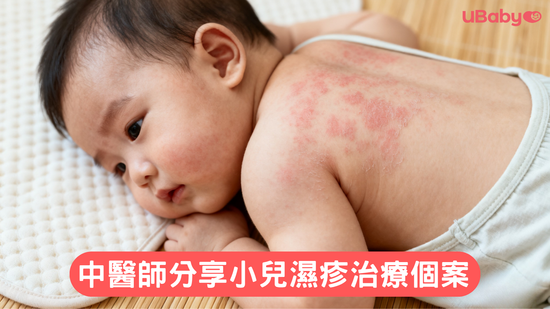 中醫師分享小兒濕疹治療個案